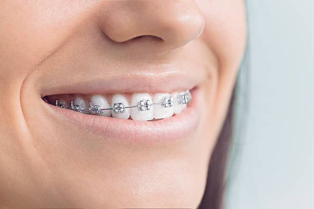 Best Traditional Braces  in Hughes Springs, TX